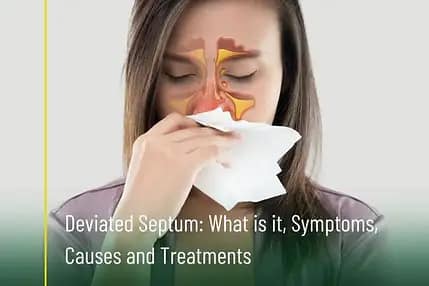 Woman experiencing nasal discomfort caused by a deviated septum.