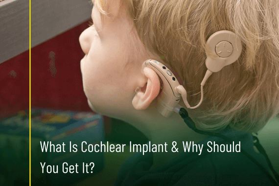 What Is Cochlear Implant & Why Should You Get It
